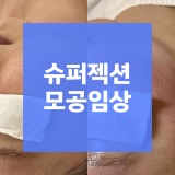 하남시청역 피부관리 슈퍼젝션 30대 모공개선 임상