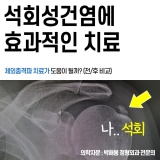 어깨석회성건염 체외충격파 치료 전/후
