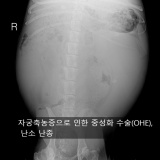 [대구동물병원][수성구동물병원][외과특화][응급진료][일요일진료] 자궁축농증으로 인한 중성화 수술(OHE), 난소 난종
