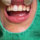한남동치과 홍치과 치아 치료의 필요성