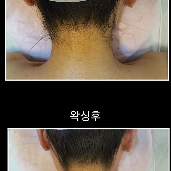 네이버 플레이스 고운손길 피부관리 : 네이버