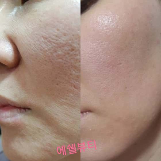 네이버 플레이스 에쉘뷰티 : 네이버