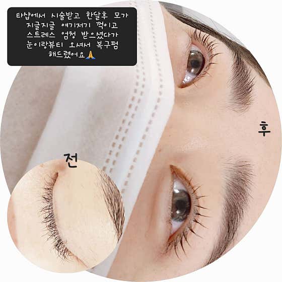 네이버 플레이스 눈이랑뷰티 : 네이버
