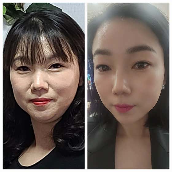 네이버 플레이스 인셀덤 B&B 대전대리점 : 네이버