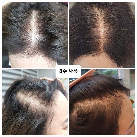 네이버 플레이스 루비셀뷰티랩 수성점 : 네이버