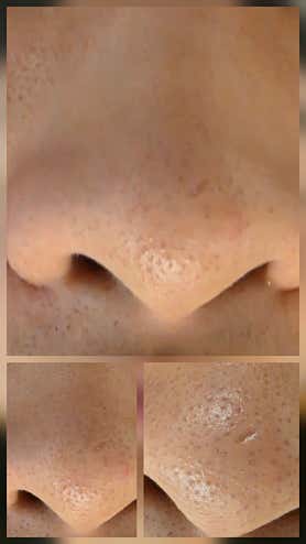 바디블링테라피 (계양) 매장 사진 3