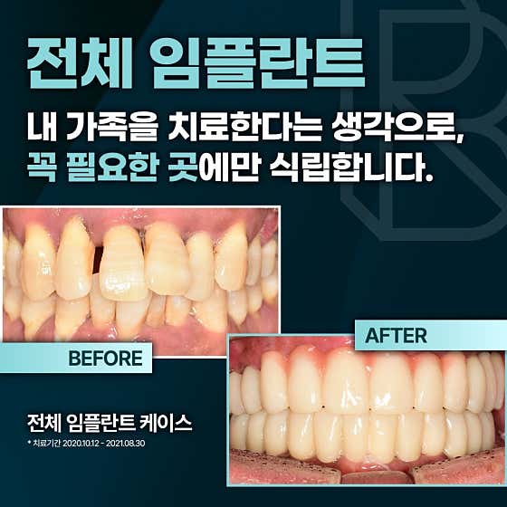 리봄치과의원 — 네이버 플레이스 업체 등록 사진 3