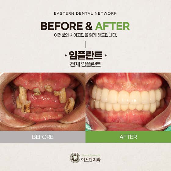 이스턴치과의원