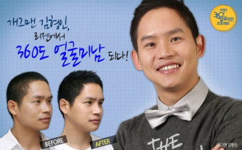 [김형인] 개그맨 김형인, 성형 당당 고백 '완전 딴 사람 됐네!'