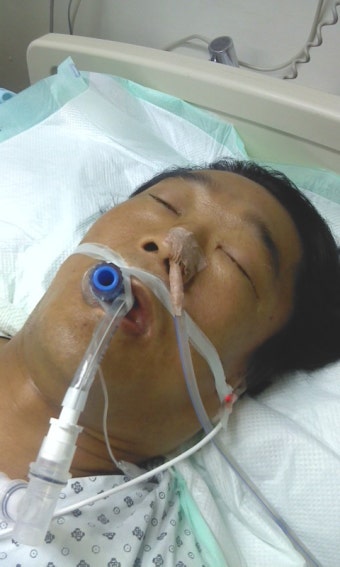 뇌출혈