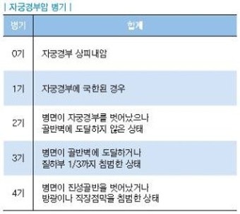 자궁암/자궁경부암수술방법/자궁경부암치료방법