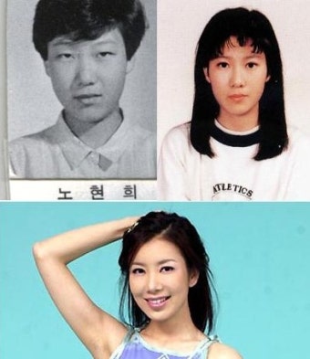 노현희 성형 전 후...
