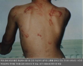 아동폭행 - 생명을 위협받는 아이들