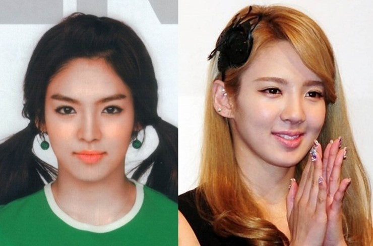 엘크레 이미지