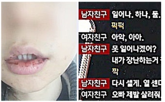 여친 폭행한 의대생... 처벌 너무 낮아요