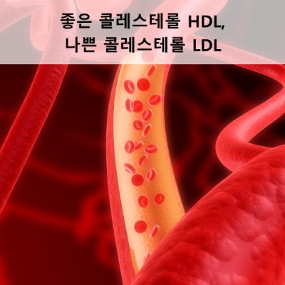 좋은 콜레스테롤 HDL, 나쁜 콜레스테롤 LDL | 블로그