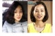 고지용 입냄새 부인 허