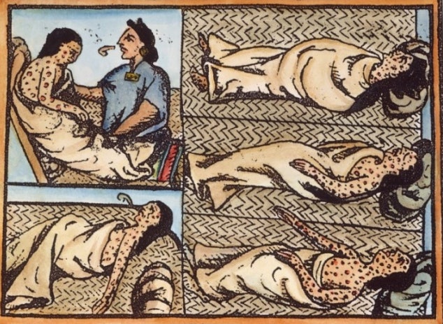 로마제국 시절 천연두: 역사 속 생생한 흔적들 2 천연두