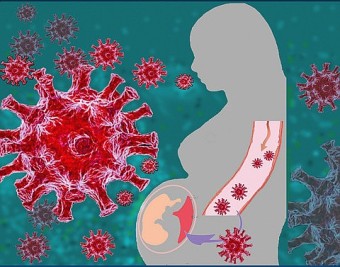 코로나 뉴스 <3> - 임신(태아)/신생아와 코로나 감염/백신