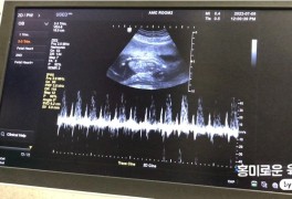 임신13주~16주차 일기, 산전기형아검사 2차 니프티(NIFT)