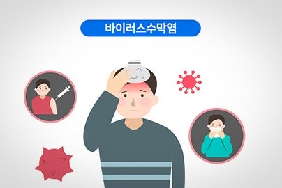 수막염의 이해와 그 역사 2 수막염