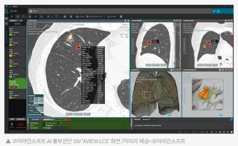 《장외주식:코어라인소프트》신한제7호스팩-코어라인소프트와 합병 결정