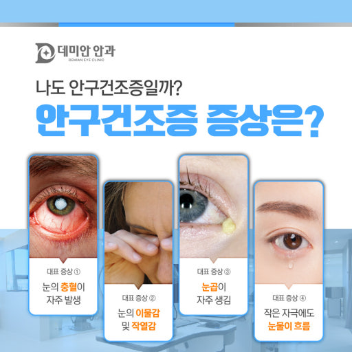 안구건조증에 좋은 꿀팁이 있을까요?