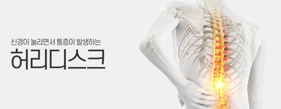 허리 디스크 환자 꼭 수술 해야하나1? 1 ?src=http%3A%2F%2Fblogfiles.naver.net%2FMjAyNDA1MjRfMTEw%2FMDAxNzE2NTIzMDM0NTAy.ahTvMw2ksMUDFBOnHF4JCFujgwYGDv6wKvyQBp56Rt0g.GdI7MJ5ze3X3WluLibng70pdR5yn0Ay7lZ VmkOaj4Ug.PNG%2F%253F%258A%25A4%253F%2581%25AC%25EB%25A6%25B0%25EC%2583%25B7 2024 05 24 %253F%2598%25A4%253F%259B%2584 12.37.56