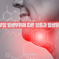 두경부암 발생부위에 따른 암종과 발생원인은?