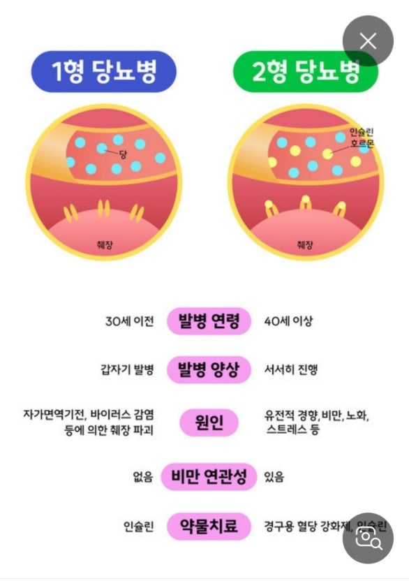 당뇨병의 위험성과 예방 방법 1 당뇨병