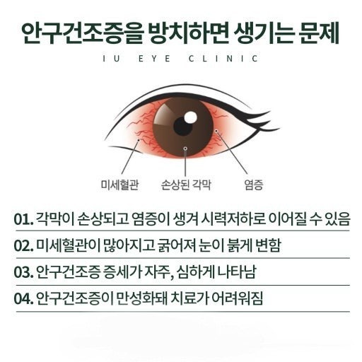 안구건조증이 고민이 되네요