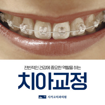 대전시청역치아교정치과 치아 정렬이 건강에 미치는 영향 알려드립니다.
