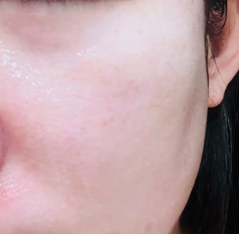 닥터원진플러스 피부과 재생크림 재생연고 피부리페어