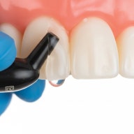 바이오클리어 vs 치아, 라미네이트, 일반 레진 : 16년차 치과 의사가 알려드립니다