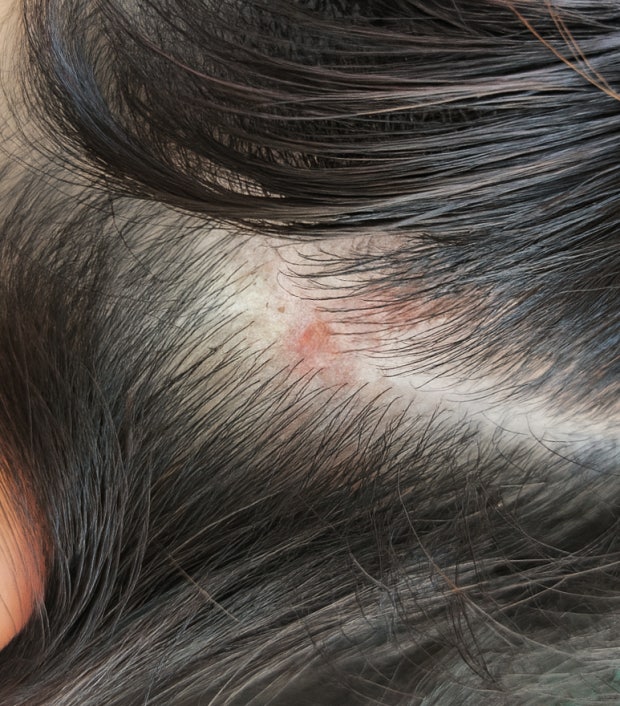 Estoy muy preocupada por mi cuero cabelludo sucio.