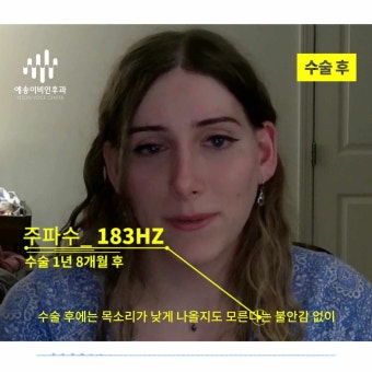 [예송이비인후과] 낮은 목소리 -> 높은 목소리로 변하길 원한다면? 예송이비인후과!