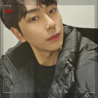 코뼈 골절 수술비 또는 코뼈 골절 치료 후기