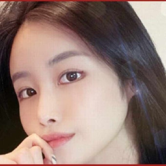코뼈 골절 진단 과정에 따른 코뼈 골절 수술 방법