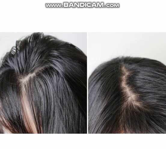48K샴푸, 각질과 비듬 완화에 탁월한 천연 성분으로 주목받아