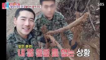 동상이몽 박군 탈모 모발이식 비용 1400만원?탈모인들만 아는 비애.