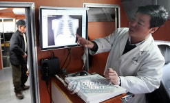 X-ray 소견 밝히는 의사