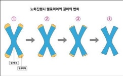 수면무호흡 증상, 몸속 노화시계 앞당긴다