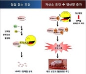 피로물질 젖산이 암세포 성장·혈관생성 촉진한다