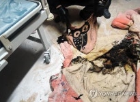 아이가 보고 싶어서…병실에 불지른 폐쇄병동 女 환자들