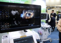 심혈관 초음파 기기