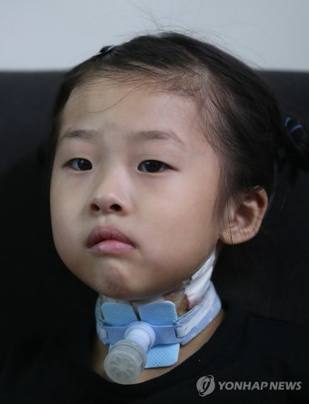 퇴원한 가습기살균제 피해자 박나원 양