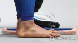[올림픽] 굳은 살 가득한 이상화의 발
