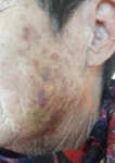 경찰, 치매 노인 뺨 수차례 때린 요양보호사 입건 조사