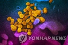 코로나19 침방울 8분 이상 공기 중에 떠다닌다