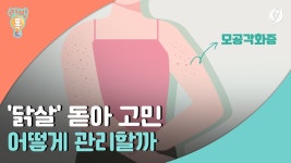 [리빙톡] 닭살 돋아 고민…어떻게 관리할까